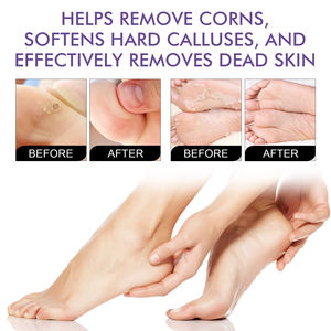 West Month 2 pares de mascarillas de lavanda para pies, para callos y durezas, hidratantes, que eliminan la piel muerta, kit de mascarillas para pies - Product Image 2