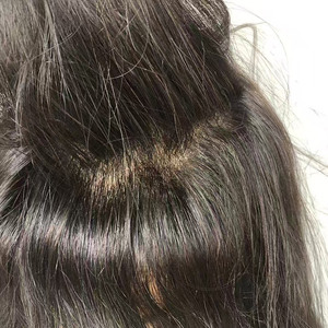 Peluca Médica de PU Fino para Mujer, 100% Cabello Humano Remy con Cutícula Alineada, Atada a Mano, Prótesis Capilar para <span class=keywords><strong>Alopecia</strong></span>, En Stock - Product Image 3