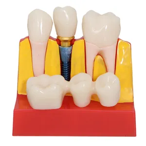 牙科产品正畸教学模型牙科4倍牙科模型