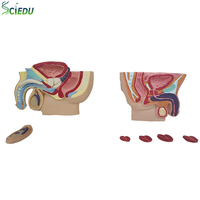 Modèle de la cavité abdominale masculine, modèle de la prostate, modèle des organes reproducteurs masculins, modèle d'anatomie humaine médicale, modèle de sciences médicales