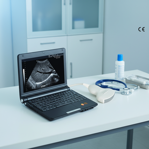 Échographe <span class=keywords><strong>portable</strong></span> noir et blanc de 10,4 pouces avec un excellent rapport qualité-prix - Product Image 1