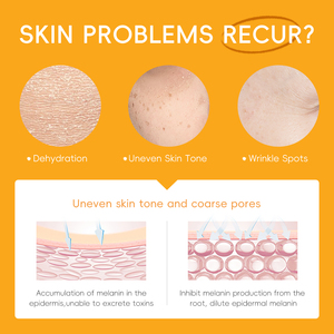 Laikou, 4 Uds., conjunto de cuidado de la piel Natural con vitamina C Vit C 20%, suministros para Spa Facial, caja de regalo de crema de colección rejuvenecedora con brillo luminoso - Product Image 3