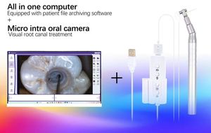 Micro caméra orale haute définition Micro caméra visuelle à lentille pour le traitement du canal radiculaire - Product Image 3