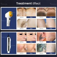 Perfectlaser - Máquina de Depilación Láser de Diodo de Alta Potencia de 4500 W, Profesional, de Alta Eficiencia, Pantalla 4K, Eliminación de Tatuajes con Láser de Picosegundos