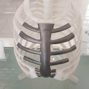 Komponen Aluminium Cetak 3D SLM/DMLS Presisi Tinggi dengan Pembentukan Cepat dan Biaya Terjangkau - Product Image 6