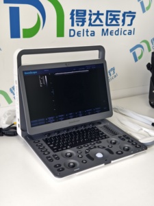 Offre Spéciale : Échographe Portable Sonoscape E1expV, E1exp, E2, E2V, E3 avec Doppler Couleur pour Usage Vétérinaire - Product Image 4