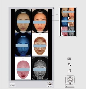 Appareil professionnel de 17 km pour analyse les images du visage, <span class=keywords><strong>Machine</strong></span> de dermologie, hôpital, chine - Product Image 6
