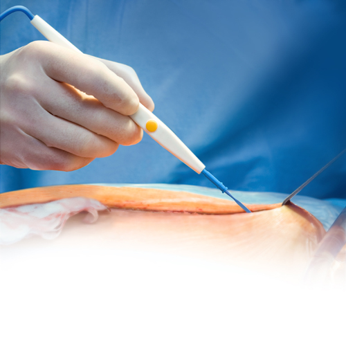 Surgical Disposable Hand Switching ESU Pencil with Cable Metal Pin for Surgical Operation