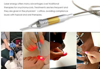 Laser à Diode Offre Spéciale 980nm pour le traitement des champignons des ongles Thérapie portable Onychomycose Dispositif de podologie le plus efficace