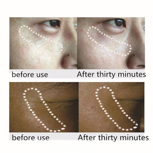 Máscara de ojos con microagujas reafirmante de alta calidad con logotipo privado que disuelve parches de microagujas HA antiarrugas parches para ojos - Product Image 5