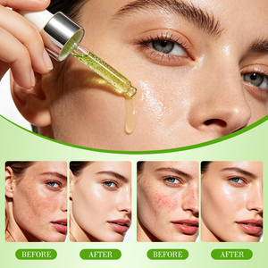 Private Label Aloe PDRN Calming <b>Serum</b> Hydrating And Barrier Repair Carry Bright Color Of Skin Improve The Skin Natural OEM <b>Serum</b> - Product Image 4