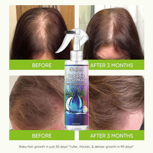 <span class=keywords><strong>Spray</strong></span> d'eau de romarin Luxfume pour la croissance des <span class=keywords><strong>cheveux</strong></span>, pour <span class=keywords><strong>cheveux</strong></span> clairsemés, soutien contre la perte de <span class=keywords><strong>cheveux</strong></span>, anti-démangeaisons, anti-pellicules - Product Image 2