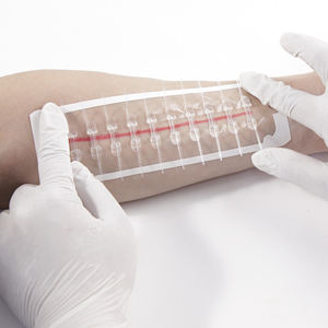 Pita penutup luka darurat | Perban kupu-kupu untuk perbaikan luka | Strip penutup renda - Product Image 1