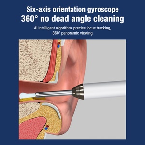 Otoscope intelligent sans fil HD, mini nettoyeur d'oreilles visuel, outil électrique d'élimination du cérumen avec caméra - Product Image 4