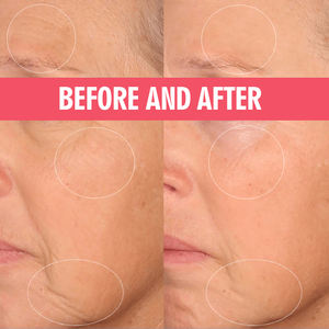 Marque privée PLLA rose crème en poudre pour le visage lifting raffermissant Anti-âge rides produits de soins de la peau hydratant pour le visage - Product Image 5