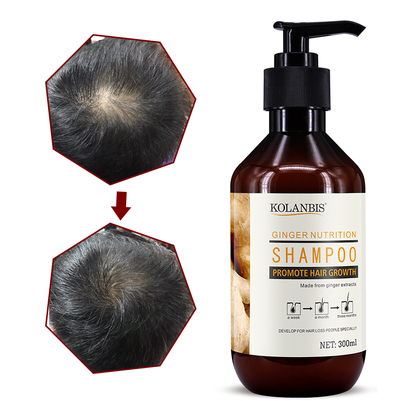 Ginger king hair regrowth shampoo private label for hair loss treatment