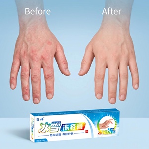 Crema Riparatrice <span class=keywords><strong>per</strong></span> Scottature, Crema Anti-screpolature <span class=keywords><strong>per</strong></span> Mani e Piedi, Lenisce la Pelle Arrossata e Pruriginosa, Balsamo Idratante 18g - Product Image 1