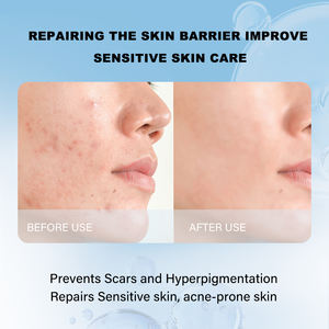 ครีมบำรุงรอบคอสำหรับกระชับผิวเพื่อลดริ้วรอยช่วยให้ผิวขาวกระจ่างใส - Product Image 5