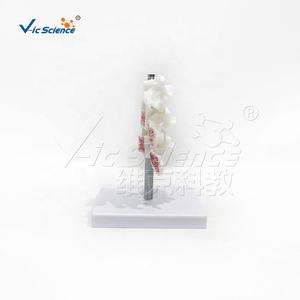 <span class=keywords><strong>Modello</strong></span> Anatomico Deluxe dell'Osteoporosi Umana PreNext con Icone Simili e Sezioni Trasversali - Product Image 4