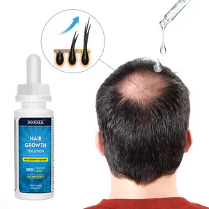 最受欢迎的头发生长草药提取物和精华力量脱发再生生物素头皮血清治疗男性