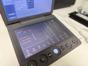 Ecógrafo Veterinario Portátil a Color de Alta Gama Sonoscape S9V para Diagnóstico por Imágenes Médicas para Hospitales y Clínicas Veterinarias - Product Image 3