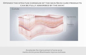 Mesin Kecantikan Wajah NewFace Standar Eropa CE FCC Profesional Hydradermabrasion Hidrasi Mendalam Tanpa Rasa Sakit Non-invasif Aqua Peel - Product Image 6