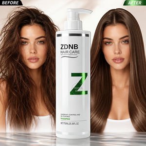 <span class=keywords><strong>Shampoo</strong></span> <span class=keywords><strong>Antiforfora</strong></span> ZDNB al Latte Proteico per il Controllo dell'Oleosità e la Lisciatura dei Capelli, Prezzo di Fabbrica - Product Image 3