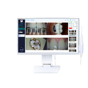 Meiliguang Medical M-568 PC Todo en Uno de 21.5 Pulgadas con Pantalla Táctil Intel Core I5 para Uso Médico - Product Image 2