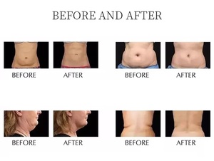 <span class=keywords><strong>Appareil</strong></span> de beauté multifonctionnel 9 en 1 avec brosse bioélectrique DDS, dispositif de destruction des graisses par <span class=keywords><strong>ultrasons</strong></span> haute intensité 80 kHz - Product Image 4