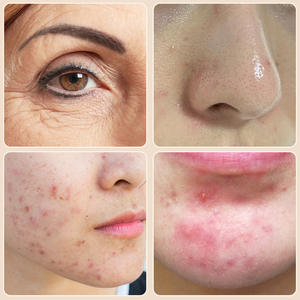 Lampu terapi lampu merah silikon 660nm + 850nm, lampu besar dapat digunakan untuk menghilangkan nyeri punggung - Product Image 2