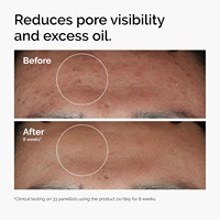 Sérum Visage Anti-Âge Bio Marque Blanche 10% Niacinamide + 1% Zinc Hydratant Contrôle Sébum Réducteur de Pores Formule Liquide