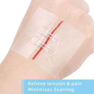 Cierre Plegable para Heridas con Cremallera, Tira de Cierre Médico para Heridas - Product Image 4