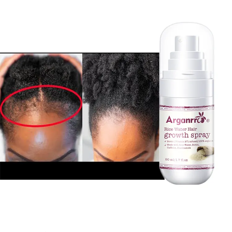 Private Label Nachwachsen Rand Reiswasser Haarwuchs Serum Spray für Frauen dünner werdendes Haar und Kahlheit