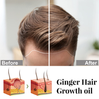 Huile de romarin naturelle de marque privée Sérum bio pour la croissance des cheveux contre la chute des cheveux Huile de romarin Produits pour la croissance des cheveux