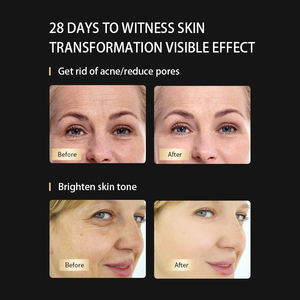 Uso doméstico 4 cores infravermelho LED Light <span class=keywords><strong>Therapy</strong></span> Máscara Facial Sistema de Silício Hand-Held Acne Tratamento Incluindo Face Neck Skin <span class=keywords><strong>Therapy</strong></span> - Product Image 5