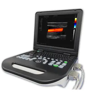 Mesin Doppler warna rumah sakit 3D, mesin <span class=keywords><strong>ultrasound</strong></span> portabel harga pabrik dengan kualitas tinggi - Product Image 1