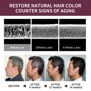 South <span class=keywords><strong>Moon</strong></span> corée polygone assombrissant shampooing cheveux gris lavage assombrissant anti perte démangeaisons soulageant le savon noir pour les cheveux gris - Product Image 4