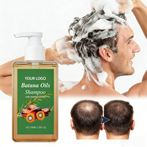 Shampooing OEM à la biotine et à l'huile <span class=keywords><strong>de</strong></span> Batana pour nettoyer le cuir chevelu, hydrater et renforcer les <span class=keywords><strong>cheveux</strong></span>, produits capillaires sains pour femmes et hommes - Product Image 1