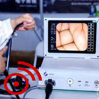 Système d'endoscopie vidéo gastrique et coloscopique vétérinaire HD tout-en-un pour cliniques vétérinaires