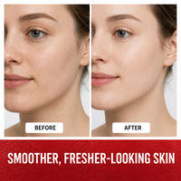 Tónico Facial Mayorista Suave para el Cuidado Diario de la Piel, Refrescante Post-Limpieza, Equilibrante e Hidratante con Pétalos de Rosa y Hamamelis