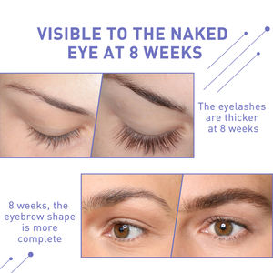 Sérum pour les cils Offre Spéciale améliorer l'huile de cils plus épaisse à base de plantes femme traitement de beauté sérum de croissance des cils - Product Image 4