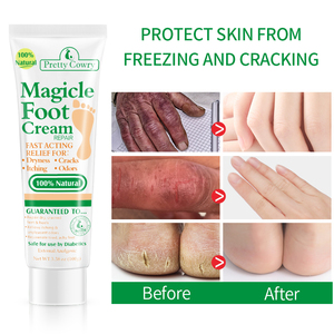 Peeling Fußpflege Ries Tool zur Entfernung abgestorbener Haut Entfernen von Fuß peeling Feuchtigkeit spendende Fußpflege creme für rissige Fersen - Product Image 3