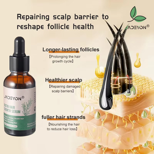 Personnalisé 100% Naturel Organique Marque Privée Essentiel Rapide Cheveux Sauvage Croissance Sérum Romarin Menthe Huile pour Femmes Noires Hommes - Product Image 2
