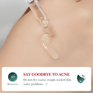 Sérum Visage Original OEM SADOER à l'<span class=keywords><strong>Acide</strong></span> <span class=keywords><strong>Salicylique</strong></span> pour l'Acné, la Niacinamide, Éclaircissant et Blanchissant, Vitamine C, Soin Cutané Ordinaire - Product Image 4