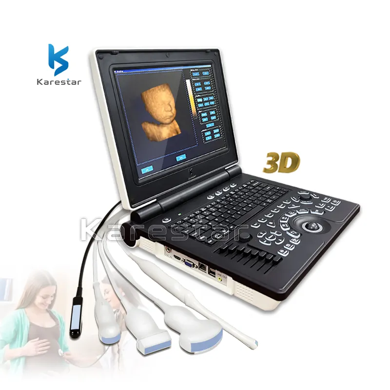 High Cost-effective 12.1 Inch 3D/4D Color Doppler Ultrasound Device Cheap Sonografo Ultrasound System