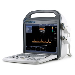 Escáner de Ultrasonido Doppler a Color Digital de Alta Resolución, Sistema de Imágenes Ultrasónicas para Embarazo, Veterinaria y Uso Humano CU23 - Product Image 2