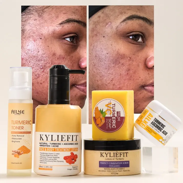 Ailke belleza Facial Anti acné envejecimiento Tumeric cara cuidado de la piel conjunto orgánico Etiqueta Privada blanqueamiento cúrcuma cuidado de la piel conjunto para mujeres