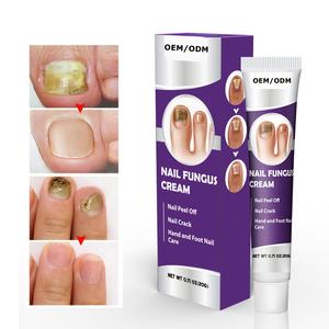 Kräuter salbe zur Behandlung von Nagel pilzen Fußpflege zur Pilz entfernung von Zehennägeln Gesundheits versorgung - Product Image 1