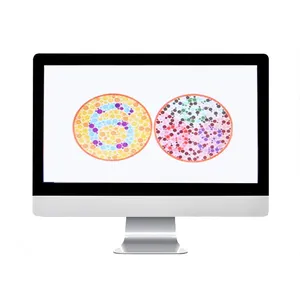 RS215A Proyector de Gráficos de Visión LCD LED de 21.5" con Apariencia MAC, Equipo Oftálmico de China - Product Image 4