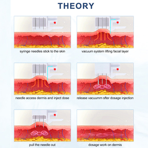 Pistola de <span class=keywords><strong>Mesoterapia</strong></span> Profesional Derma Pro de Corea, Inyector Vital para Rostro, Cuerpo, Cabeza y Labios, Blanqueamiento, Antienvejecimiento, Rejuvenecimiento de la Piel, Uso Médico - Product Image 3